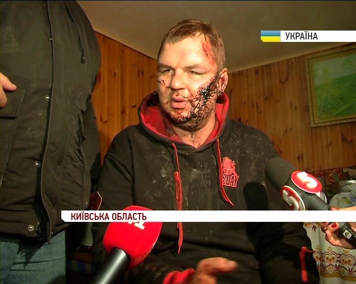 Милиция пытается задержать лидера Автомайдана Булатова в больнице - нардеп Милиция пытается задержать лидера Автомайдана Булатова в больнице - нардеп