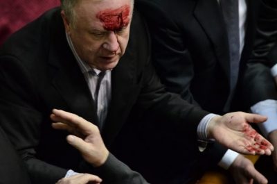 После драки в Раде регионал попал в больницу с тяжелой травмой головы