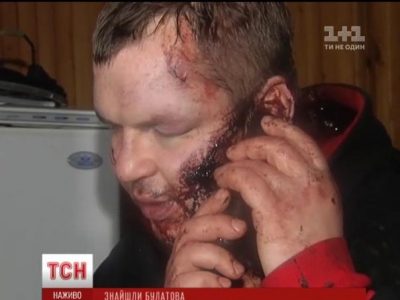 Опубликованы новые фото активиста Булатова после пыток