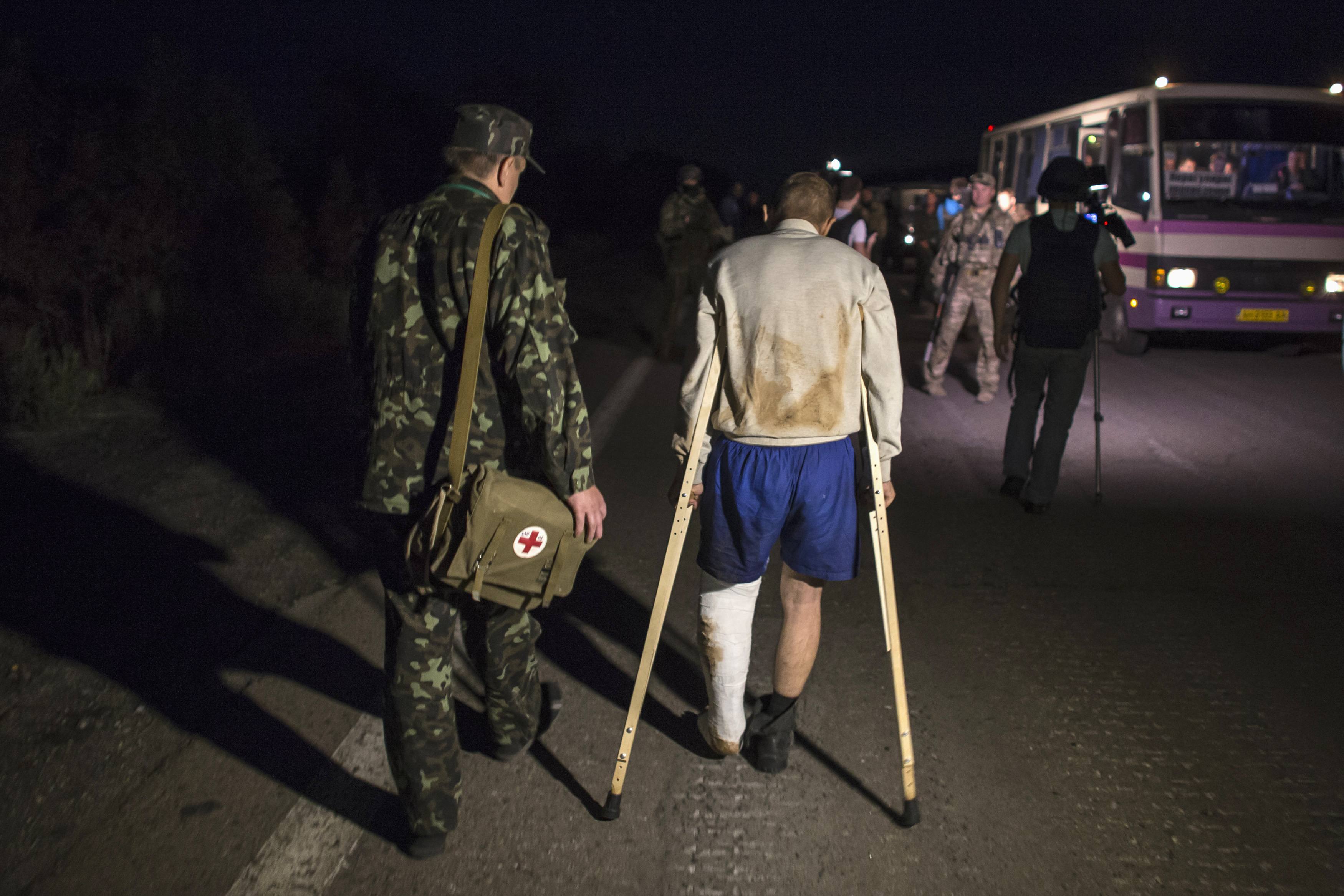 Обмен п. Пленные сепаратисты на Донбассе. Изувеченные пленные на Украине.