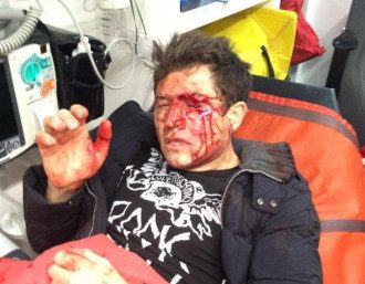 В Киеве жестоко избили шоумена Джеджулу