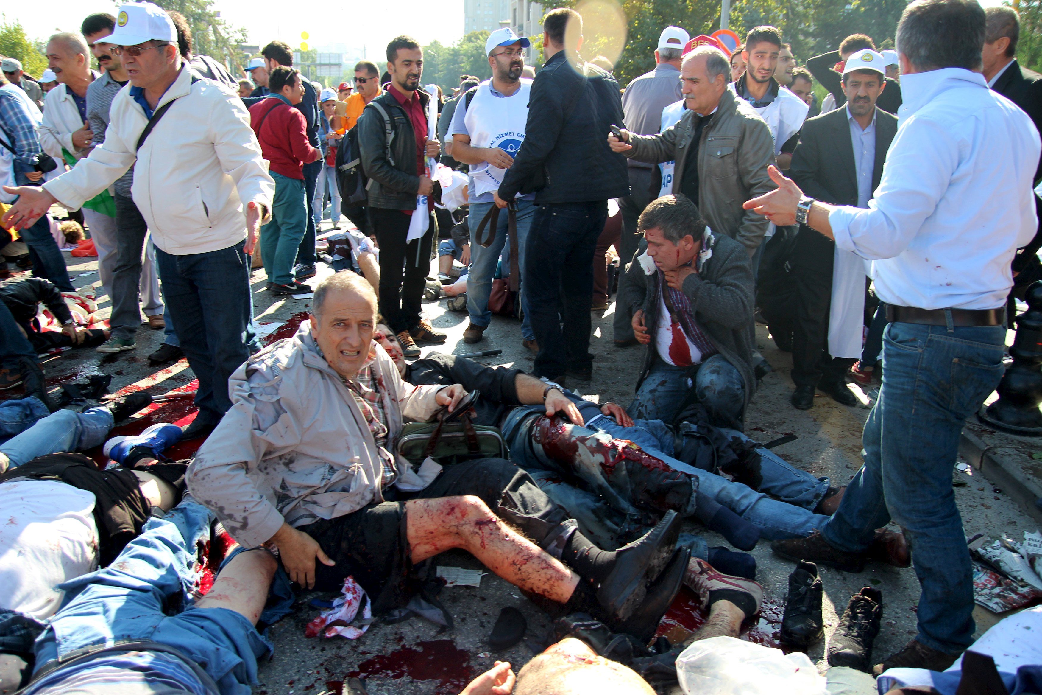 Теракты в Анкаре: погибли 30 человек, 126 ранены