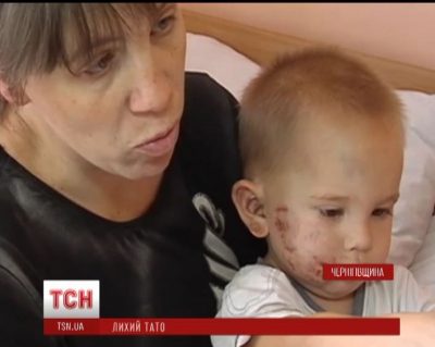 За жизнь двухлетнего мальчика борются медики. За жизнь двухлетнего мальчика борются медики.
