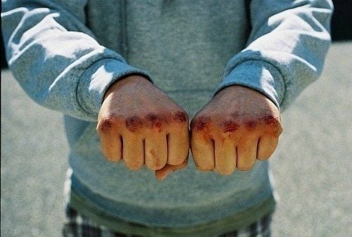 В Запорожье подростки поиздевались над девушками - Новости Запорожья В Запорожье подростки поиздевались над девушками - Новости Запорожья