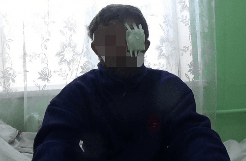 Боевик, взятый в плен под Авдеевкой, пожаловался на подельников: опубликовано видео допроса
