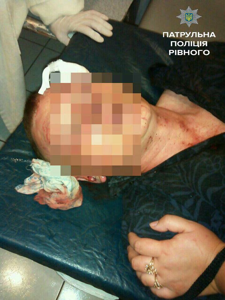 Азербайджанец жестоко избил участника АТО. Азербайджанец жестоко избил участника АТО.