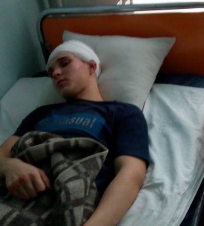 Зверское избиение парня под Киевом. Мать сказала, что подростки хотели его убить
