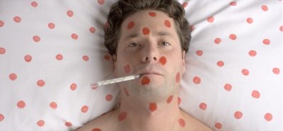 Минздрав не будет объявлять эпидемию кори в Украине Минздрав не будет объявлять эпидемию кори в Украине