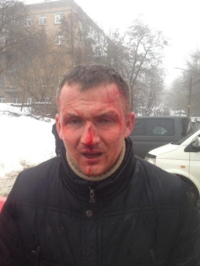 В Киевраде заявили, что нардепа Левченко избили до потери сознания. У полиции своя версия