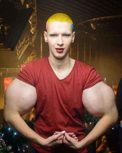 "Мама кормит с ложечки": Руки-базуки срочно лишился самого дорогого