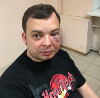 Александра Шуфрича избили в ресторане