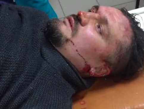 В Запорожье избили активиста Сергея Мазуренко