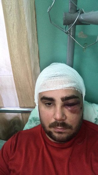 Активист получил тяжелые травмы / Фото: Facebook/Влад Погорелов Активист получил тяжелые травмы / Фото: Facebook/Влад Погорелов