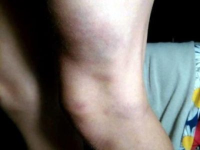 В Полтаве тренер избивала учениц / fakty.ua