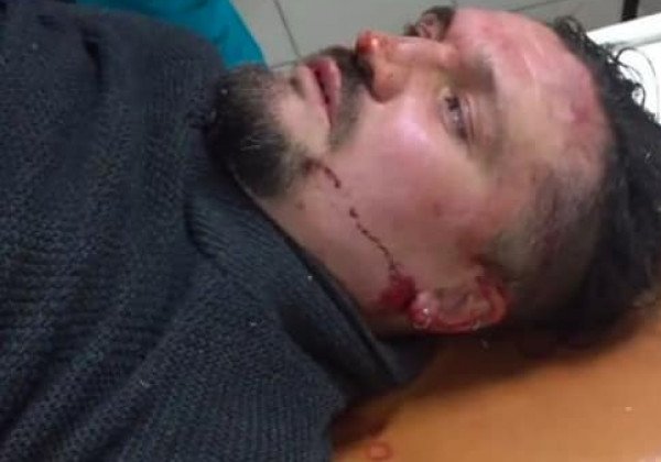 "Шакалята бесхребетные": в Запорожье жестоко избили известного активиста