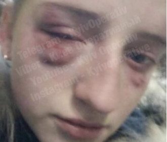 В Киеве жестоко избили школьницу / Скриншот/Киев Оперативный В Киеве жестоко избили школьницу / Скриншот/Киев Оперативный