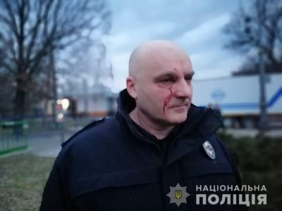 Начальнику ГУ НП в Черкасской области Валерию Лютому рассекли лицо./ npu.gov.ua Начальнику ГУ НП в Черкасской области Валерию Лютому рассекли лицо./ npu.gov.ua