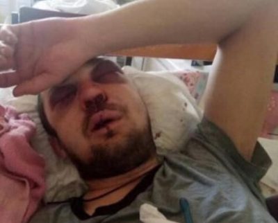 "Добивал с ноги": на Киевщине маршрутчик жестоко избил пассажира за 2 гривны