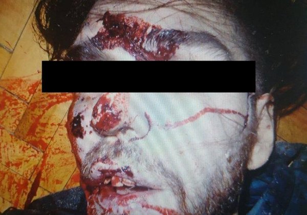 Подробности взрыва в киевской многоэтажке: жертвой оказался разыскиваемый убийца из РФ