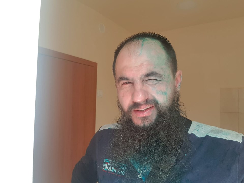 В Харькове одиозному сепаратисты плеснули зеленкой в лицо