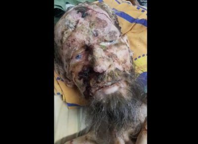 Мужчина был ужасно истощен и фактически превратился в мумию / Скриншот