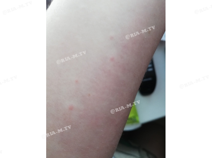 Морские блохи атакуют Кирилловку