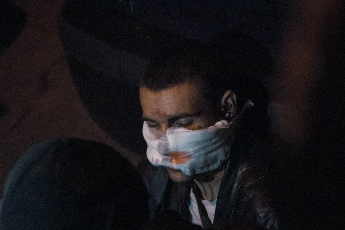 В Киеве мужчина ограбил офис депутата, потом его ранили и задержали