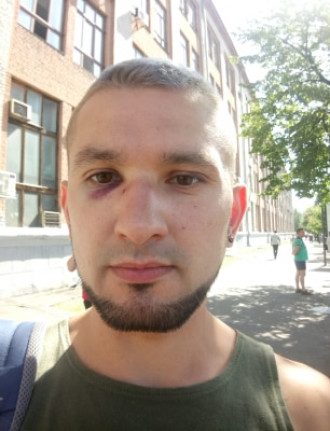 Cовершили жестокое нападение на открытого гея — ветерана АТО Cовершили жестокое нападение на открытого гея — ветерана АТО