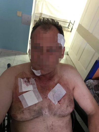 Окровавленному таксисту вызвали скорую прохожие/ Facebook Андрей Небытов Окровавленному таксисту вызвали скорую прохожие/ Facebook Андрей Небытов