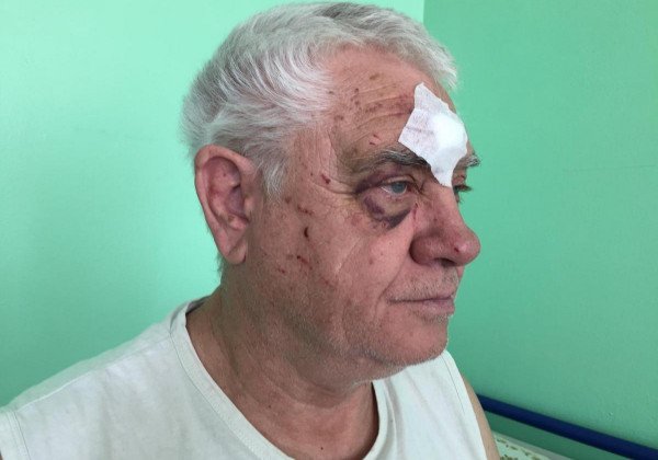 "С*ка старая, учить меня будешь?": в Харькове полицейский жестоко избил пенсионера