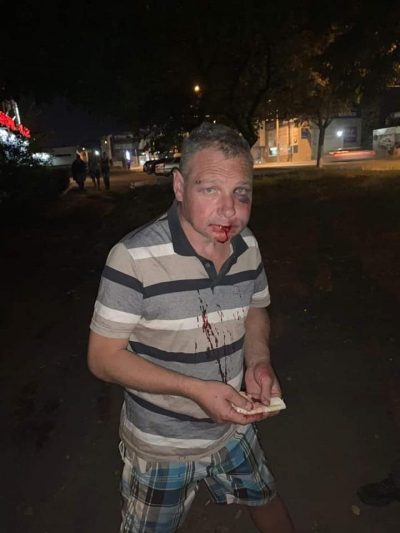 "Мало п*зды дали": в Днепре жестко проучили живодера, мучившего собак