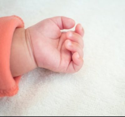 В Черновцах родились сиамские близнецы / из открытых источников