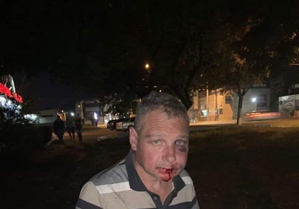 "Мало п*зды дали": в Днепре жестко проучили живодера, мучившего собак