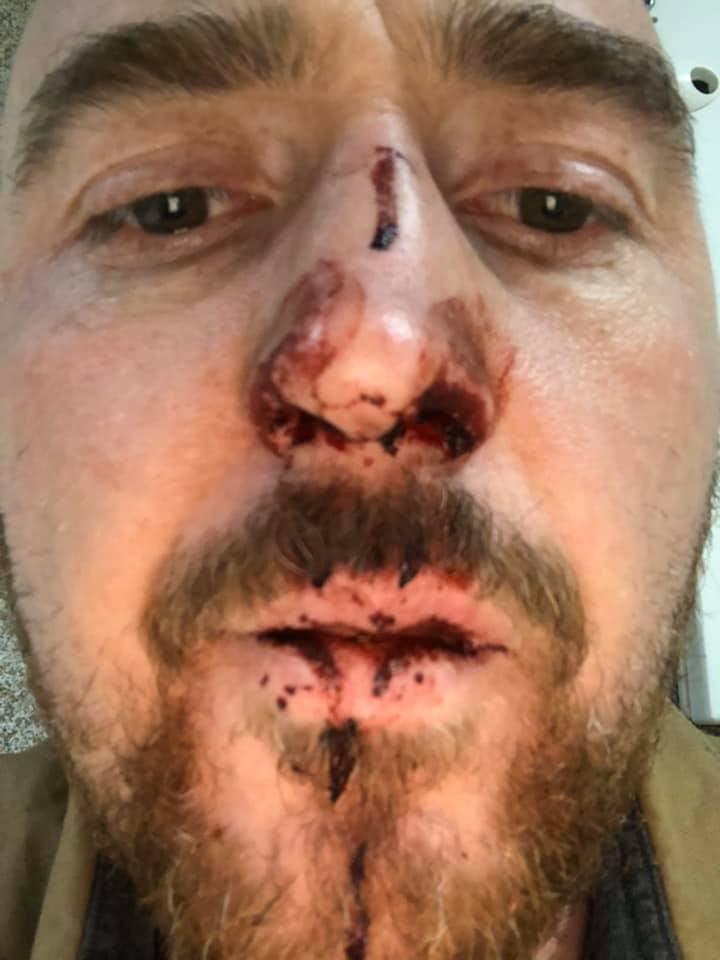 Украинского актера избили в Польше