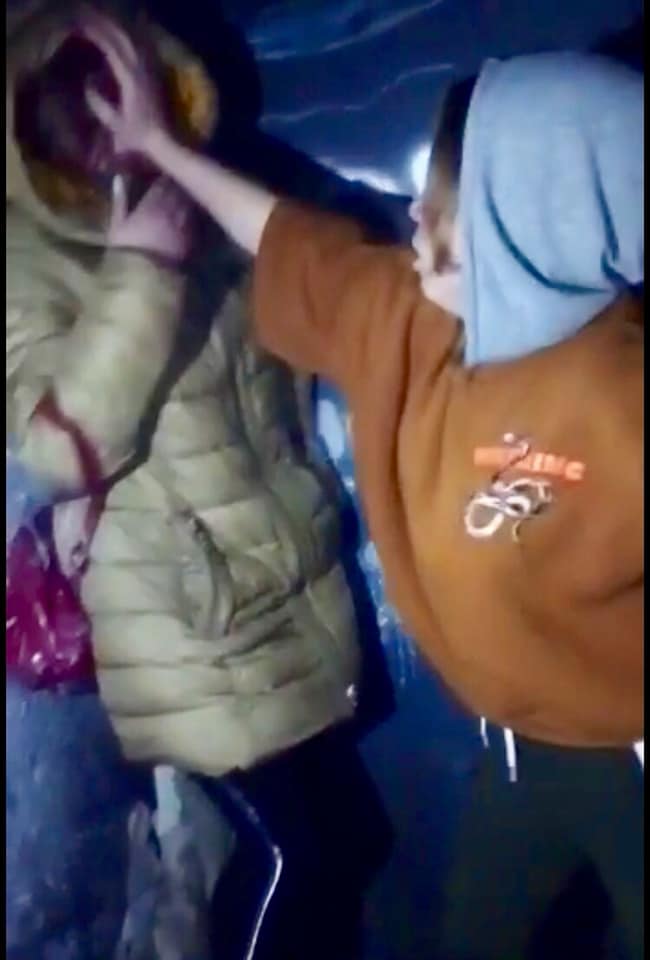 В Харькове подростки жестоко избили сверстницу