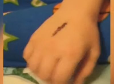 Кровавые следы на теле: украинских школьников захлестнула опасная игра