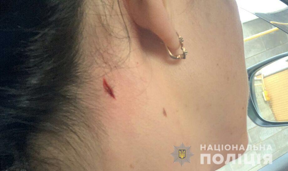 На Николаевщине женщина заявила о ранении у полицейского полигона