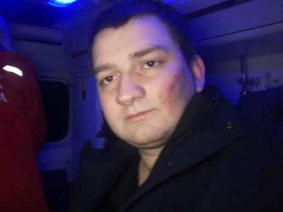 В Сумах неизвестные в балаклавах напали на "слугу народа"