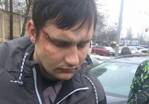 "Быдлота, урылки недоделанные": в Киеве пьяный водитель разбил пять автомобилей