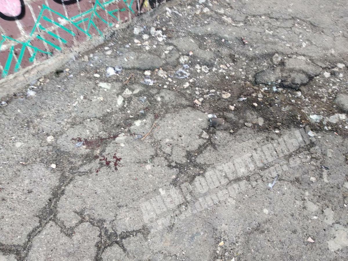 У Дніпрі семирічній дитині вибухом відірвало руку: подробиці і фото У Дніпрі семирічній дитині вибухом відірвало руку: подробиці і фото
