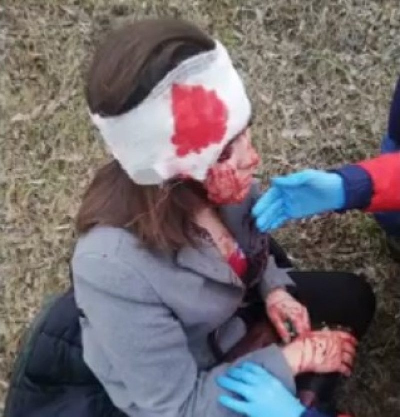 "Виродкові строк забезпечений": у Києві таксист відключився за кермом і врізався в стовп - відео