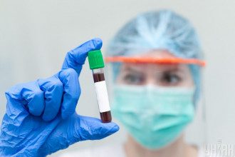 За добу в Києві знайшли рекордну кількість хворих на коронавірус – Коронавірус статистика За добу в Києві знайшли рекордну кількість хворих на коронавірус – Коронавірус статистика