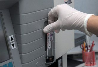 Аксенов поделился, что в Крыму за сутки коронавирус нашли у 157 человек – Коронавирус Крым статистика Аксенов поделился, что в Крыму за сутки коронавирус нашли у 157 человек – Коронавирус Крым статистика