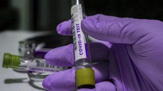 Эксперт поделился, где обязательно нужно проводить тестирование на коронавирус – Тестирование на коронавирус Эксперт поделился, где обязательно нужно проводить тестирование на коронавирус – Тестирование на коронавирус