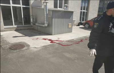 Куля роздробила щелепу: спливло відео з місця стрілянини у бізнесмена Мультика Куля роздробила щелепу: спливло відео з місця стрілянини у бізнесмена Мультика