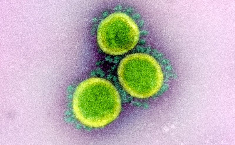 Ученые выяснили, что является предвестником смерти от COVID-19