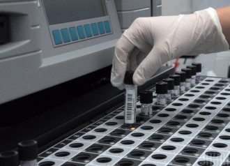 Вірус вбив ще тисячі осіб – Коронавірус 1 травня 2020 року в Україні та світі Вірус вбив ще тисячі осіб – Коронавірус 1 травня 2020 року в Україні та світі