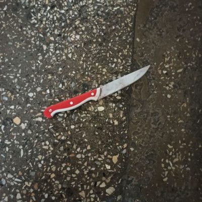 У Києві в лікарні чоловік організував різанину: фото 18+