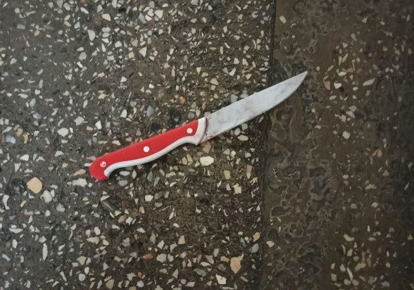 У Києві в лікарні чоловік організував різанину: фото 18+