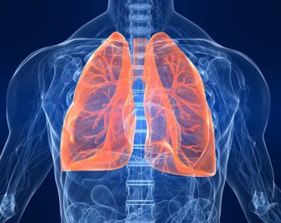 Рак, легкие Рак, легкие